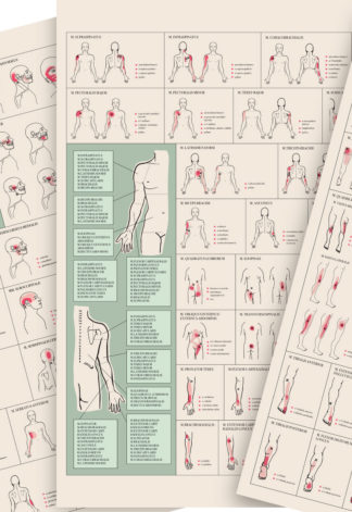 Triggerpiste-kartat (3 kpl)